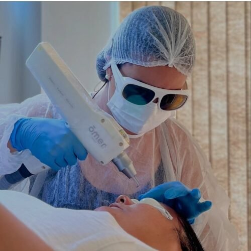 keity Suane – Remoção em Micropigmentação e Tatuagem a Laser
